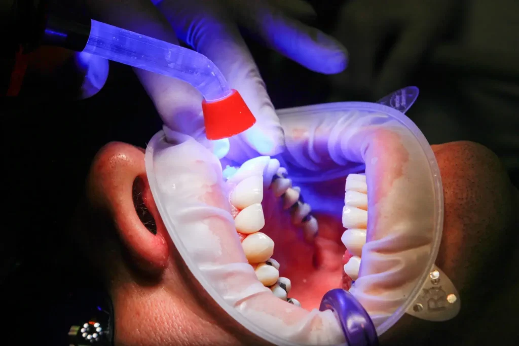 single tooth implant cost without insurance